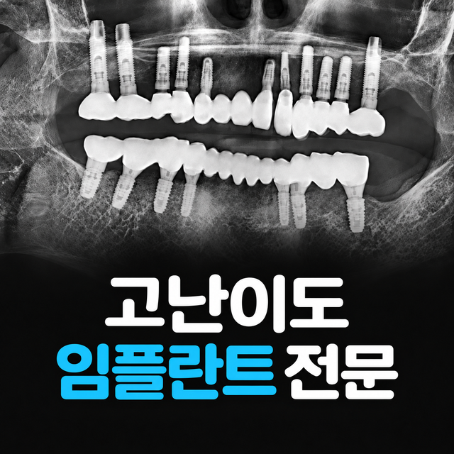 고난이도 임플란트, 뼈이식부터 전체 임플란트까지
